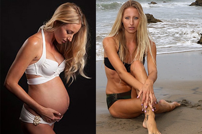 before-and-after-pregnancy-weight-loss